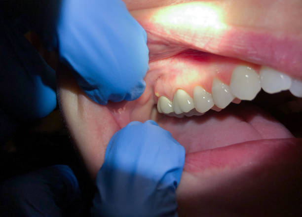Best Walk-In Emergency Dental Services in Mcnary, AZ